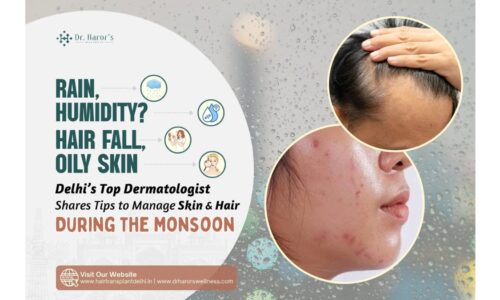 Rain, Humidity, Hair Fall, Oily Skin? Delhi’s Top Dermatologist Shares Tips to Manage Skin & Hair During the Monsoon